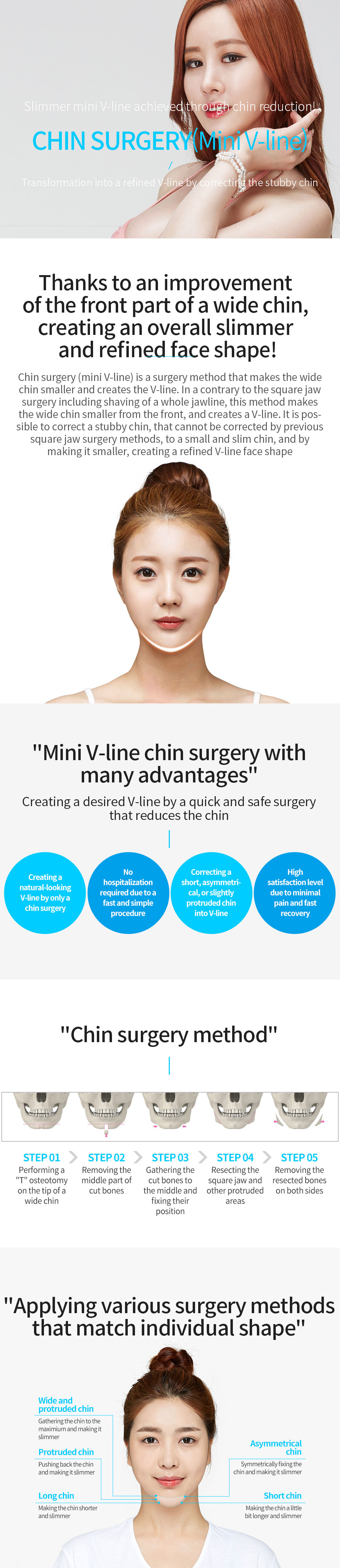 Glovi Chin Surgery img