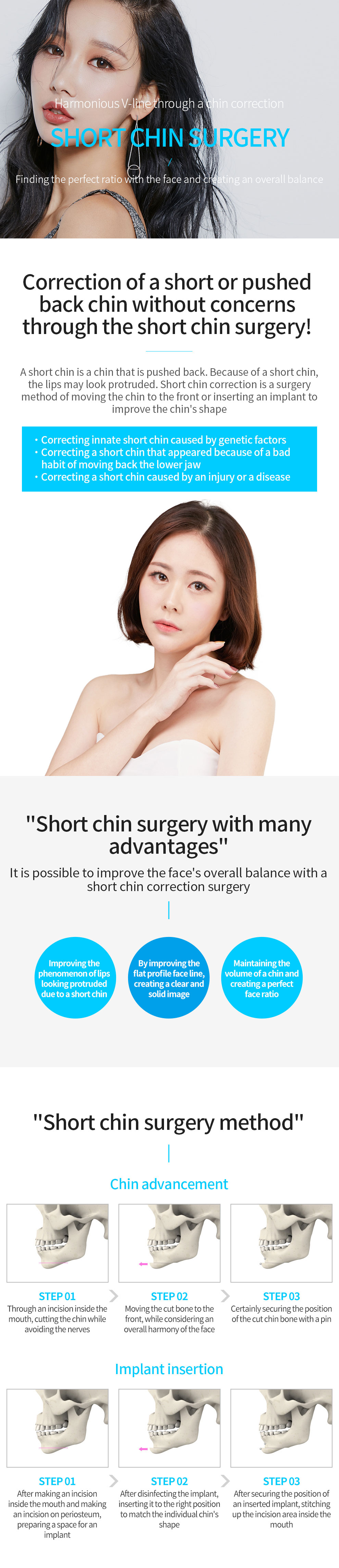 Glovi Short Chin Surgery img