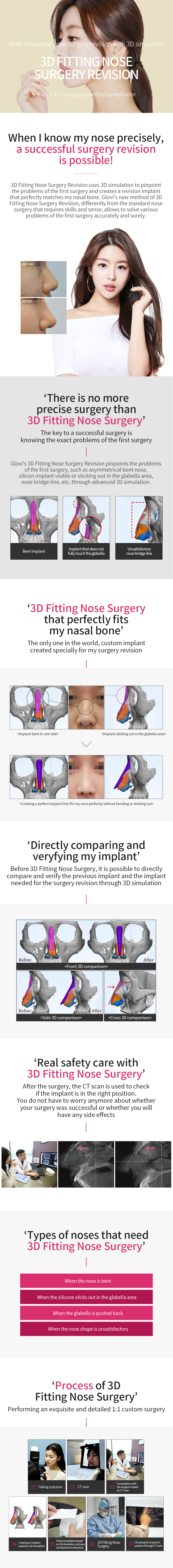 3D Fitting Nose Surgery Revision img
