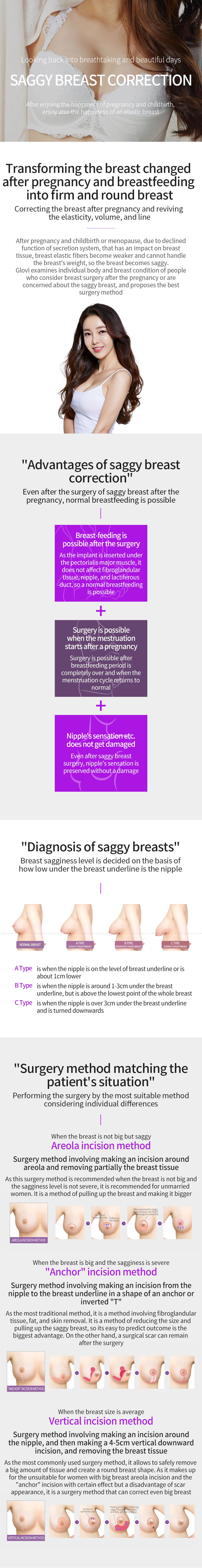 Glovi Saggy Breast Correction img
