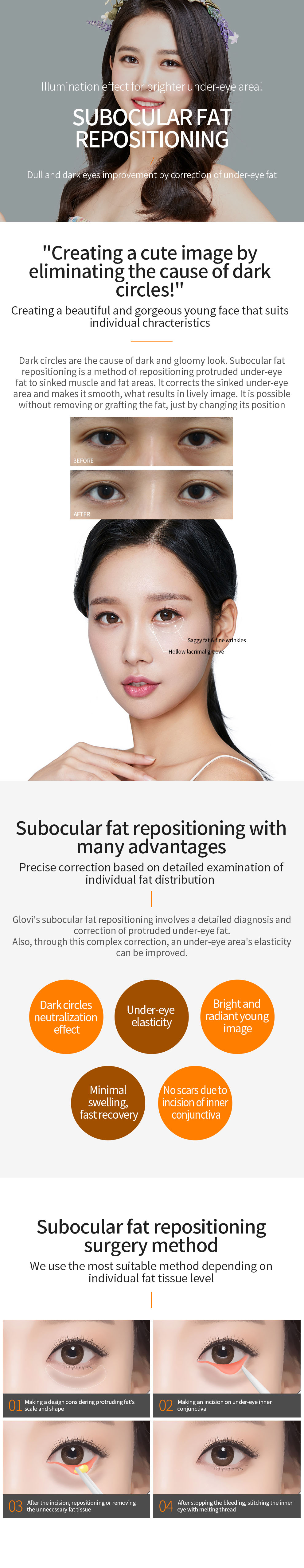 Glovi Subocular Fat Repositioning img